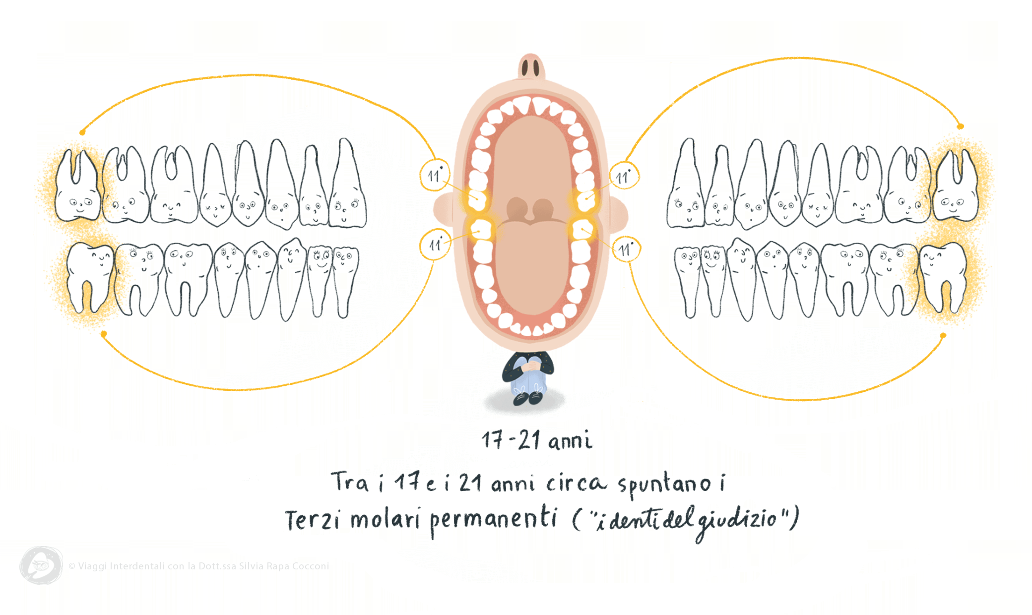 Tra i 17 e 21 anni spuntano i terzi molari permanenti ovvero i denti del giudizio - Viaggi Interdentali